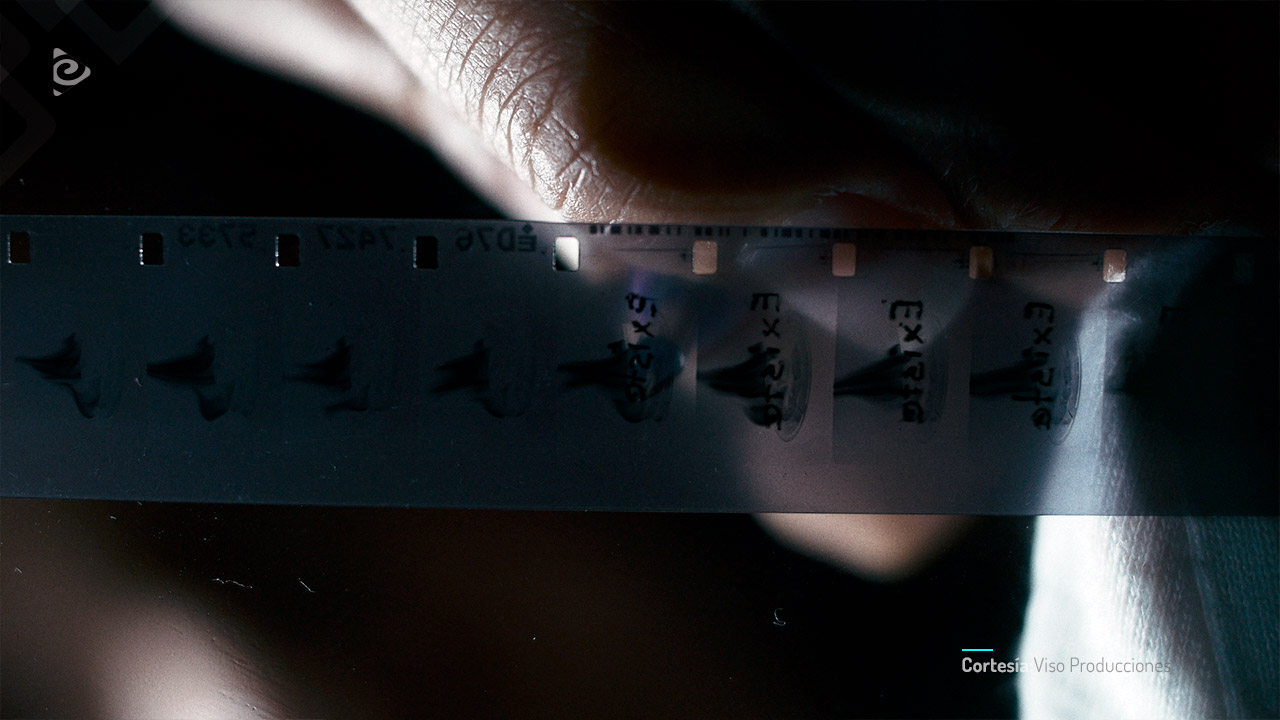 Plano detalle de intervención de fílmico.