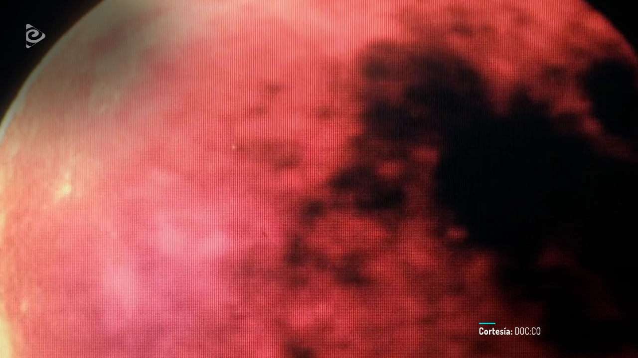 Mi bestia, película colombiana disponible en RTVCPlay