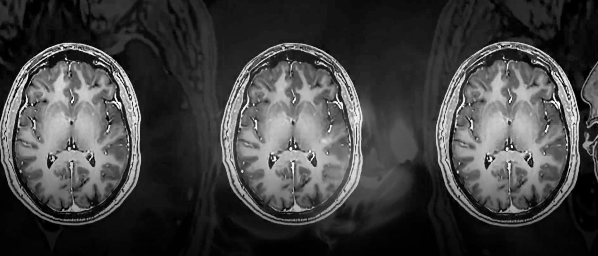 Mira ahora el cortometraje documental Donantes de memoria en la plataforma de streaming de los colombianos: RTVCPlay