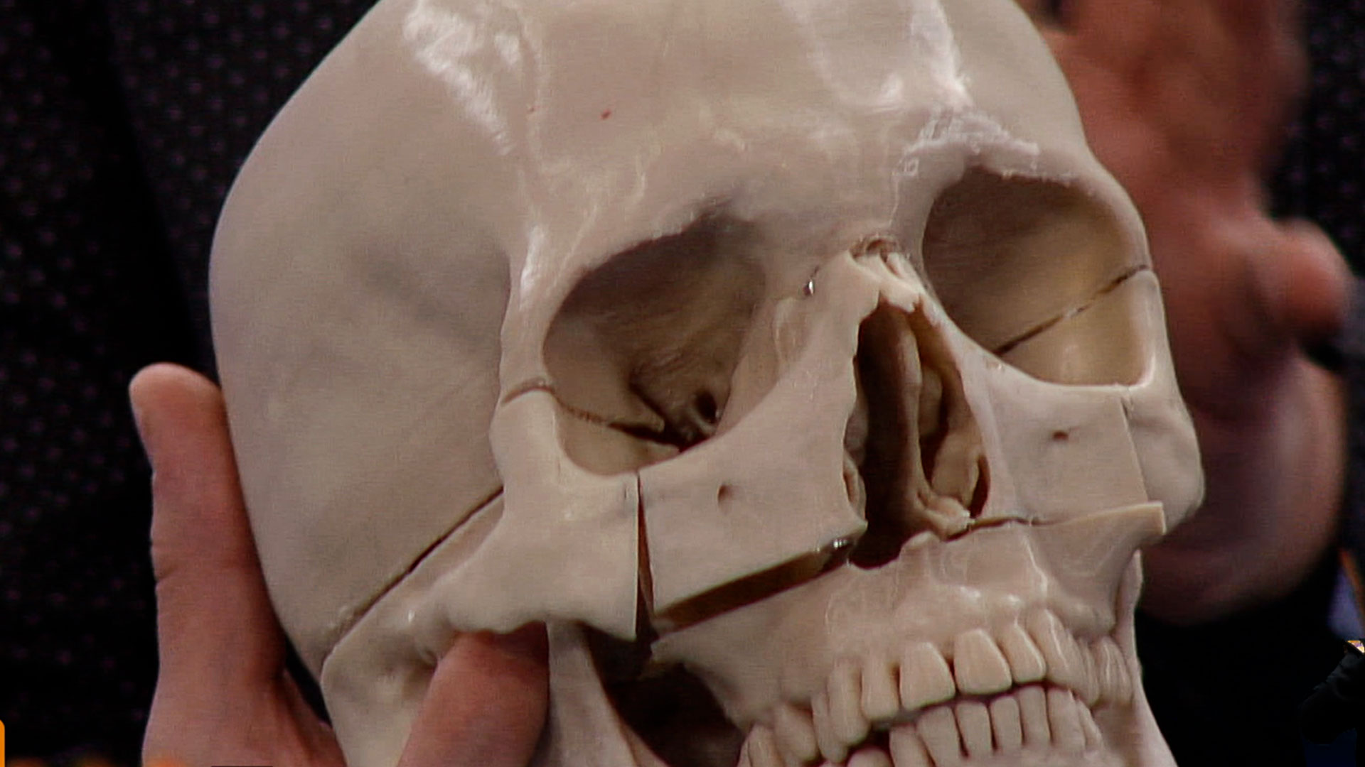 cráneo, calavera, huesos del cuerpo humano, fractura, profe en tu casa, series colombianas, series educativas, series en rtvcplay